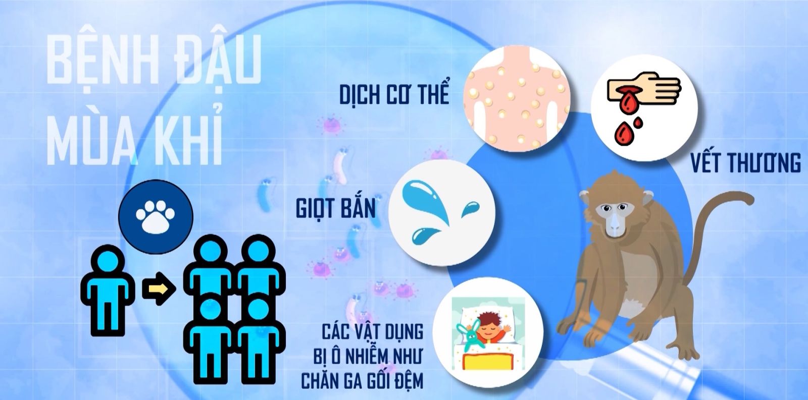 Bệnh đậu mùa khỉ đường lây truyền và cách phòng tránh